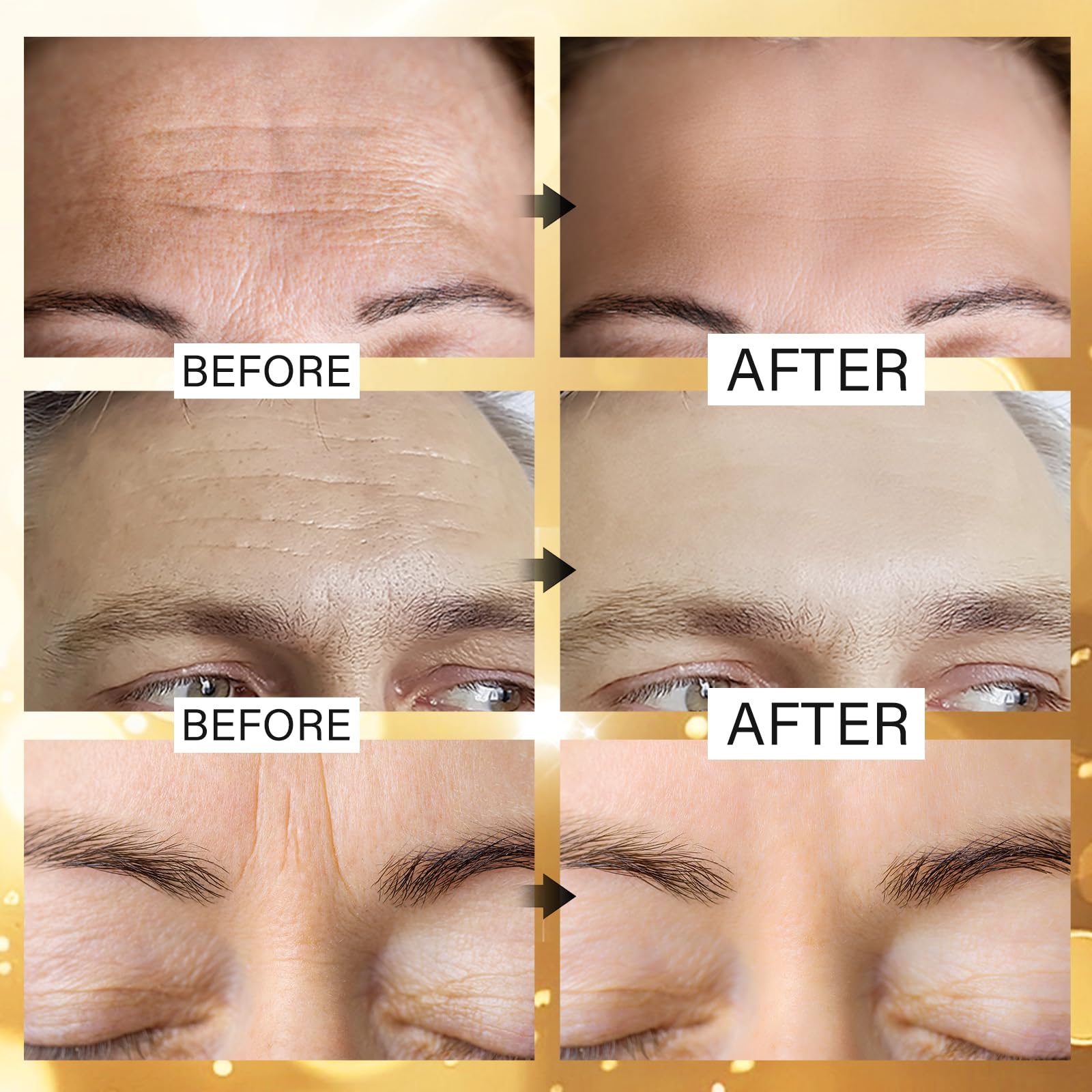 Jakuva 24K Gold Forehead Wrinkle Patches for Face-Hydrogel Pads with Hydrolyzed Collagen And Vitamin E, Forehead Wrinkles Care for Strips Moisturizing,20PCS