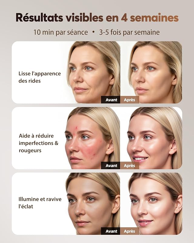 3D Masque LED Visage Luminothérapie, Sans Fil, 272 LEDs, NVV10