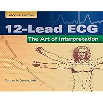 Chou's Electrocardiography in Clinical Practice: Adult and