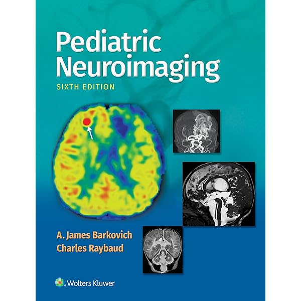 Amazon.com: Osborn's Brain E-Book eBook : Osborn MD, FACR, Anne G