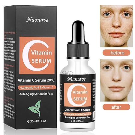 Vitamin C Serum Hochdosiert, Gesichtsserum mit Reiner Hyaluronsäure und Hochwertigem Vitamin C, Hyaluronsäure Serum für Gesic