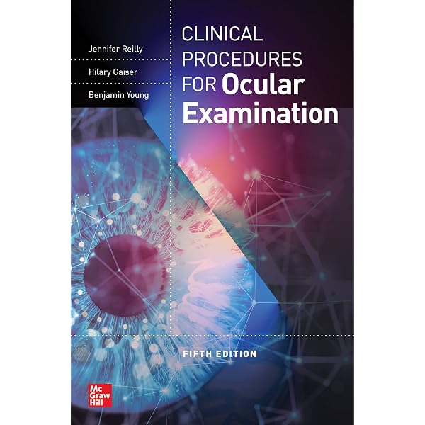 Amazon.com: Clinical Management of Binocular Vision eBook