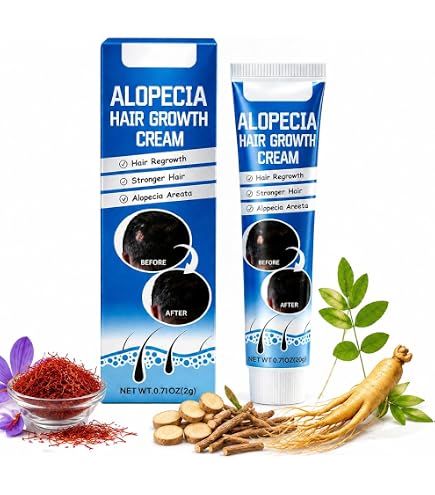 Amazon.com : ALOPECIA Amazing Hair Growth with Biotin 4oz : Beauty