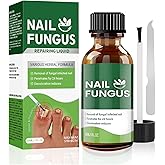 Toenail Fungus Treatment Extra Strength,7Days Nail FungusTreatment for Toenail,7 Pure Natural Plant Extracts,ToeNail Fungus Treatments for Thick, Broken (1 Fl Oz (Pack of 1))