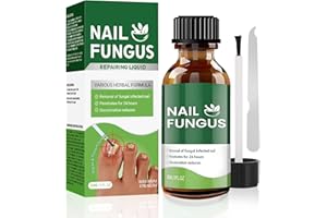 CALPOL Toenail Fungus Treatment Extra Strength,7Days Nail FungusTreatment for Toenail,7 Pure Natural Plant Extracts,Toe Nail Fungus Treatments for Athletes Foot, Thick, Broken, Discolored & Damaged Nail