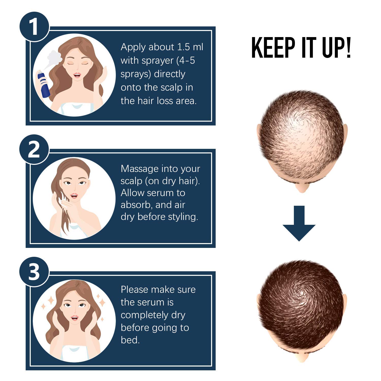 Hair Growth Spray, LamFun Professional Hair Loss Treatment, 5% Minoxidil Solution for Hair Loss, Thinning and Regrowth, Topical Treatment for Men & Women, Alcohol-Free. (100ML) : Beauty