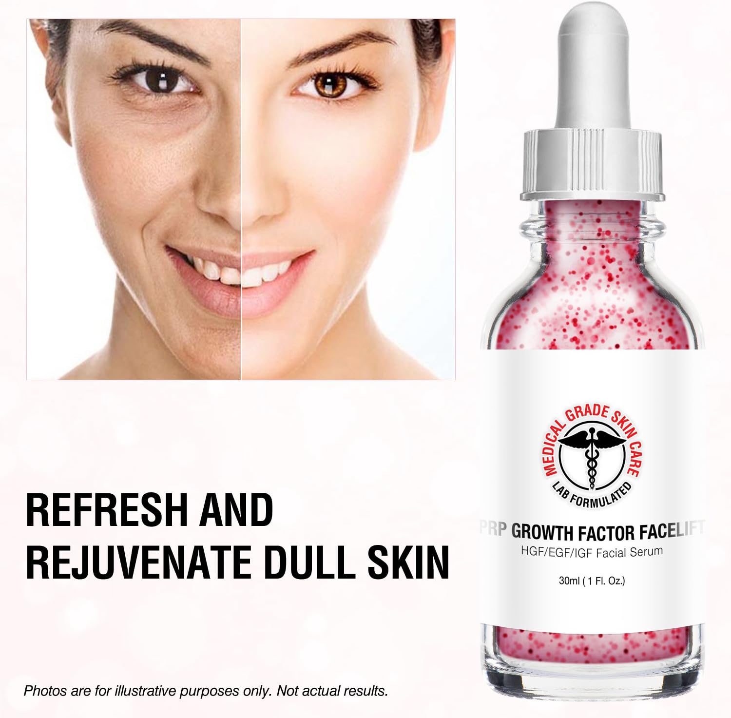 vampire facial serum