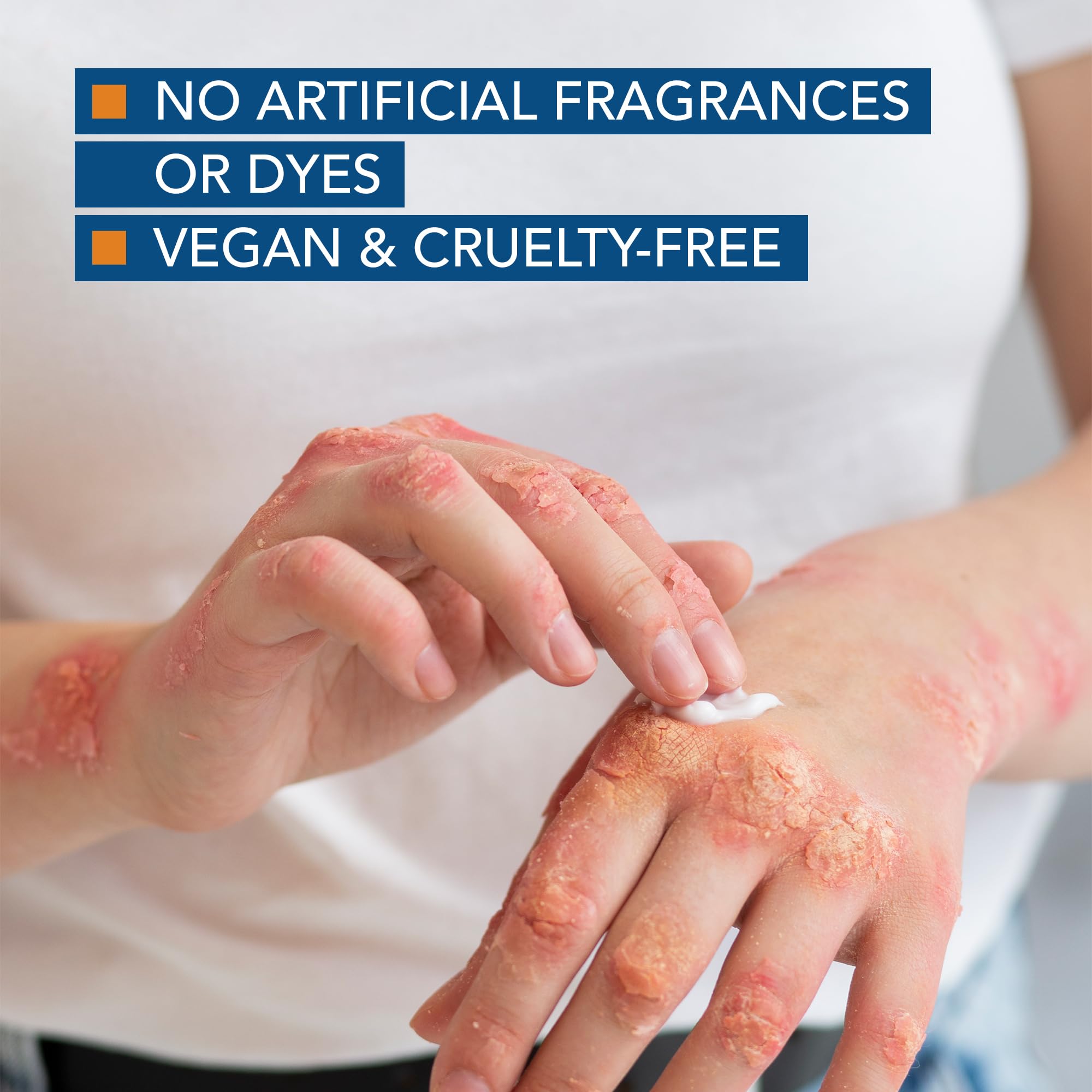 Kenkoderm Psoriasis Cream - Natural Moisturizing Face & Body Lotion with 2 Percent Salicylic Acid - Renewing Topical Formula for Dry & Sensitive Skin, Fragrance & Color Free, 10 oz., 1 Jar