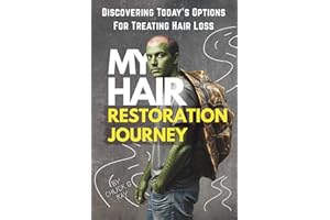 My Hair Restoration Journey