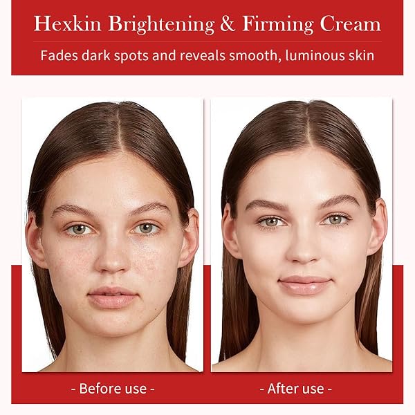 HEXKIN FACE MOISTURIZER CREAM – LIGHTWEIGHT HYDRATING KOREAN GLASS SKIN CARE FOR SOFT, RADIANT SKIN | DAILY GLYCERIN FACIAL CREAM FOR DRY & SENSITIVE SKIN | 1.41 OZ