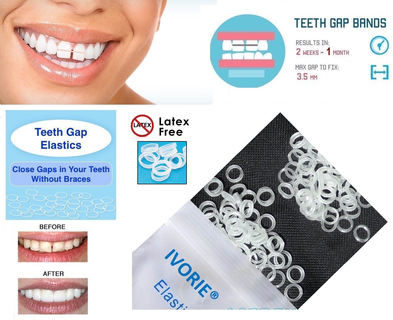 IVORIE Teeth Gap Bands Orthodontic Bands Clear Dental