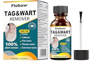 Skin Tag Removal Kit, Wart Remover, Effective Remover of Warts, Moles and Calluses, Mole & Wart Removal Liquid for Body and H