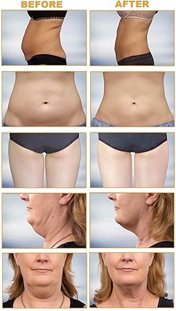 Amazon.com: Ariana Spa Supplies 5 in 1 RF RF Face & Body Slimming & Shaping 3D Smart Technology Treatment Device Machine [US Warranty & US Based Tech ...