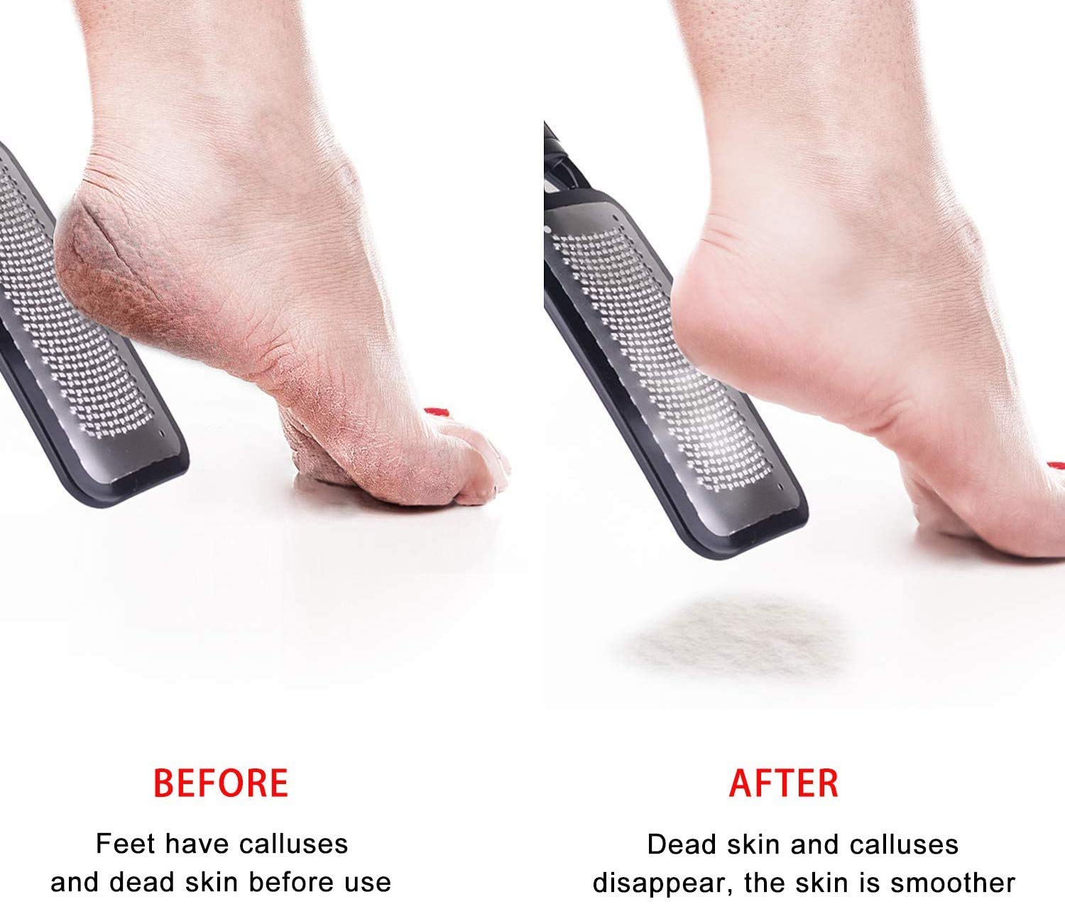 ZECLIN Pedicure Rasp Foot File, Foot Scrubber, Callus Remover, Stainless Steel Foot Files for Easy Trimming Dead Skin, Callus, Foot Corn, Cracked Heels, Can be Used on Both Wet and Dry Feet (Black) : Beauty