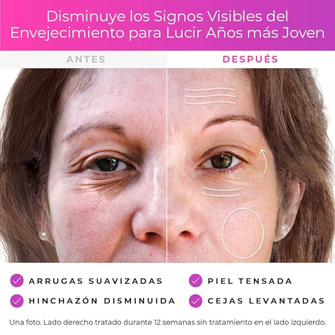 dermawand best price