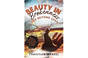 Beauty in Brokenness: Life Beyond Legs