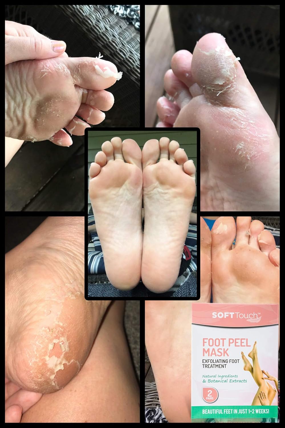 Foot Peel Mask – 2 Pack of Peeling Booties – Natural Foot Care Exfoliating Treatment Repairs Cracked Heels, Calluses & Removes Dead, Dry Skin for Baby Soft Touch Feet: Beauty