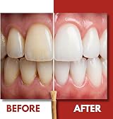 SEWAK Miswak Sticks 10 Pack | Organic Wooden Toothbrush for Teeth Whitening view 5