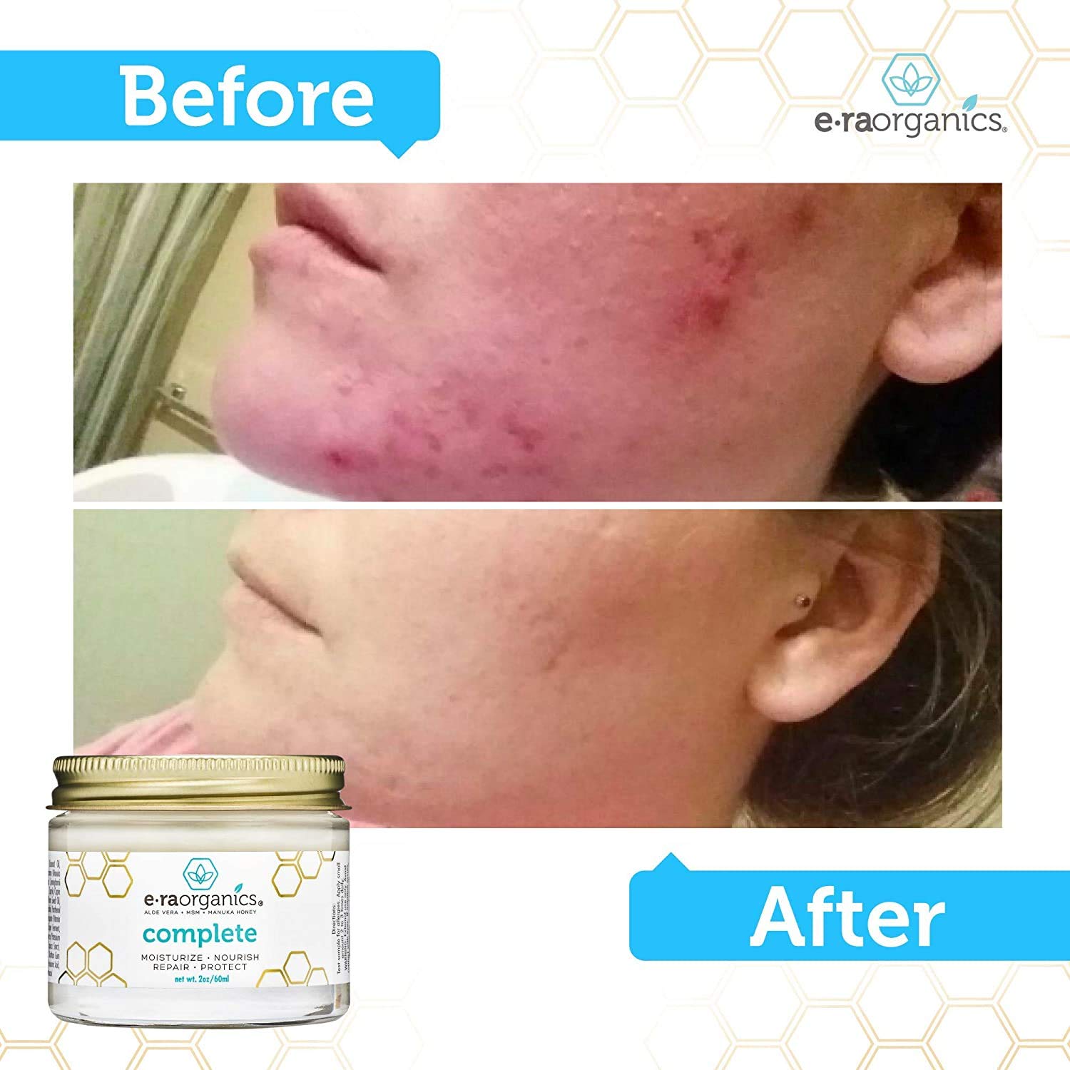 Natural & Organic Face Moisturizer Cream - Extra Nourishing & Hydrating 10-In-1 Daily Facial Cream with Aloe Vera, Manuka Honey, Coconut Oil, Cocoa Butter For Oily, Dry, Sensitive Skin Era-Organics: Beauty