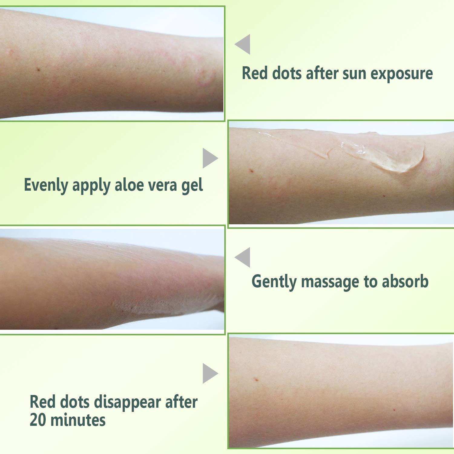 aloe vera gel good for scars