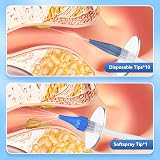 Qimic Ear Wax Removal Kit Ear Cleaner with 10 Tips Complete Home Kit view 5