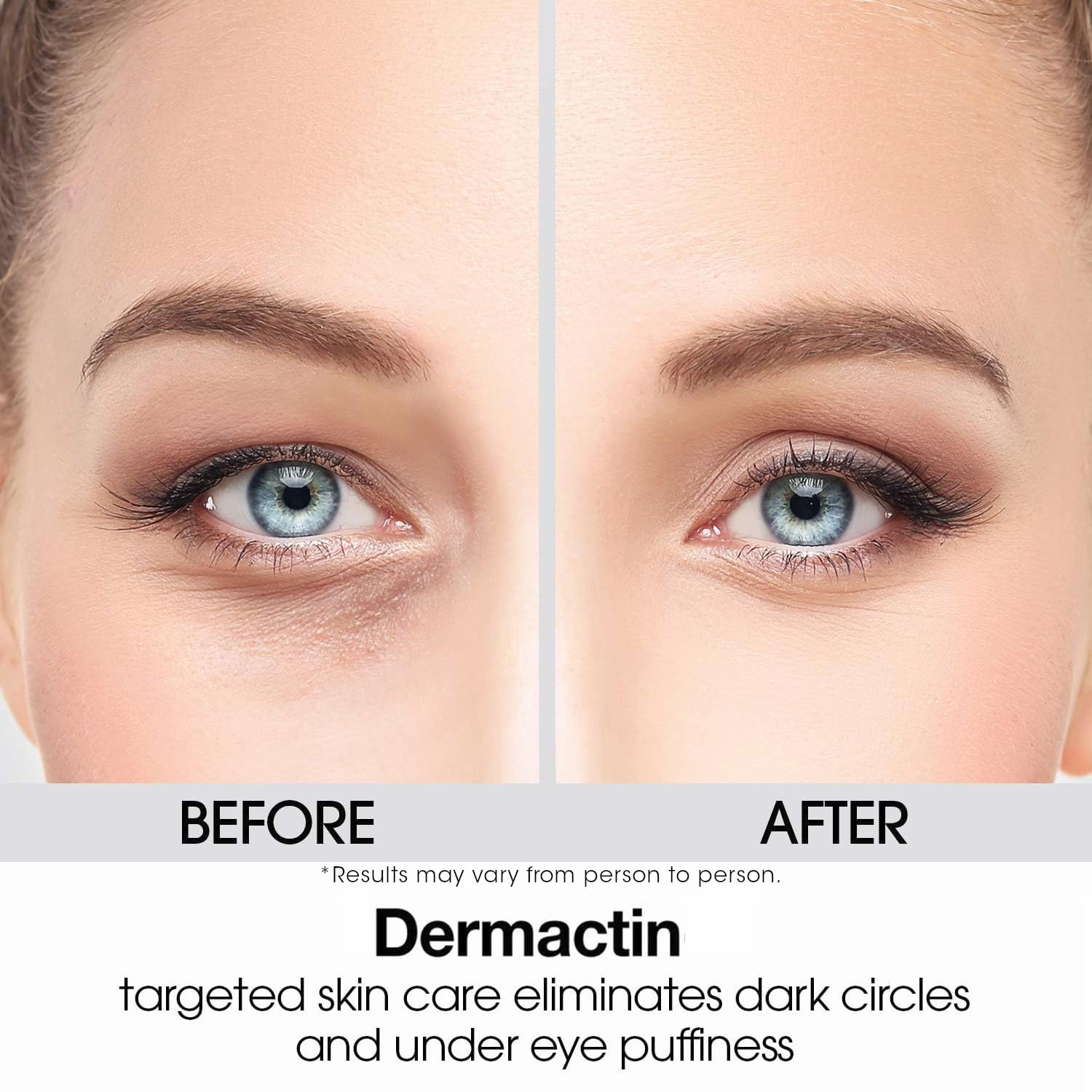 Dermactin Upper Eyelid Cream 1 oz. Firms & Tones Sagging & Drooping Skin On Upper Eye Lids, for Younger, More Vibrant & Alert Appearance, for Sensitive Skin In The Eyelids