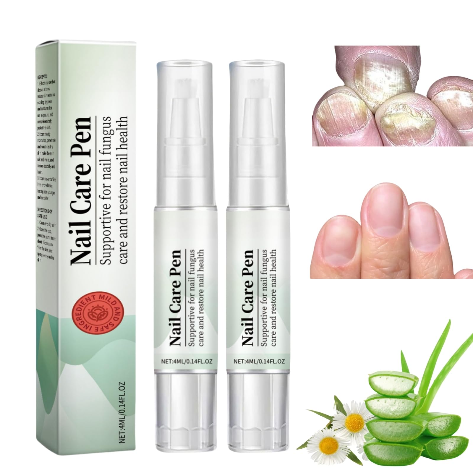 2PCS Nail Care Pen,Fungal Nail Treatment Pen,Cosmetic Care for Nail Fungus,Toenail Fungus Treatment Pen,Fungal Toenail Treatment,Antifungal Nail Polish,Nail Repair Pen for Nail