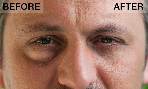 under eye instant tightening cream