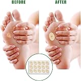 MEKEET 120Pcs Corn Cushions Oval Soft Latex Sponge Toe Plasters view 4