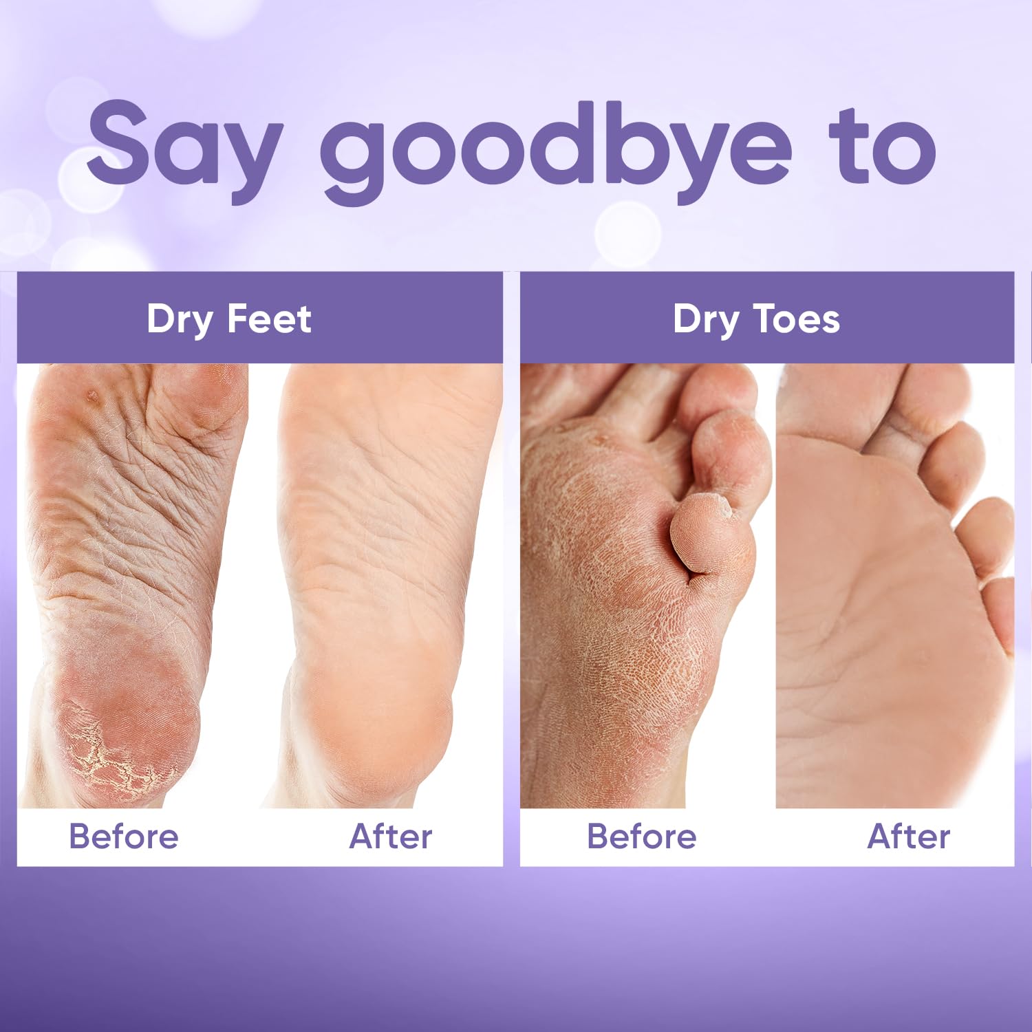 Foot Peel Mask - Foot Mask for Baby Soft Skin - Remove Dead Skin, Dry, Cracked Feet & Callus, Foot Spa, Made with Aloe Vera Extract for Women and Men (2 Pair (Pack of 1), Lavender)
