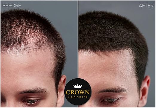 Amazon Com Crown Hair Fibers Best Keratin Hair Fibers Instantly