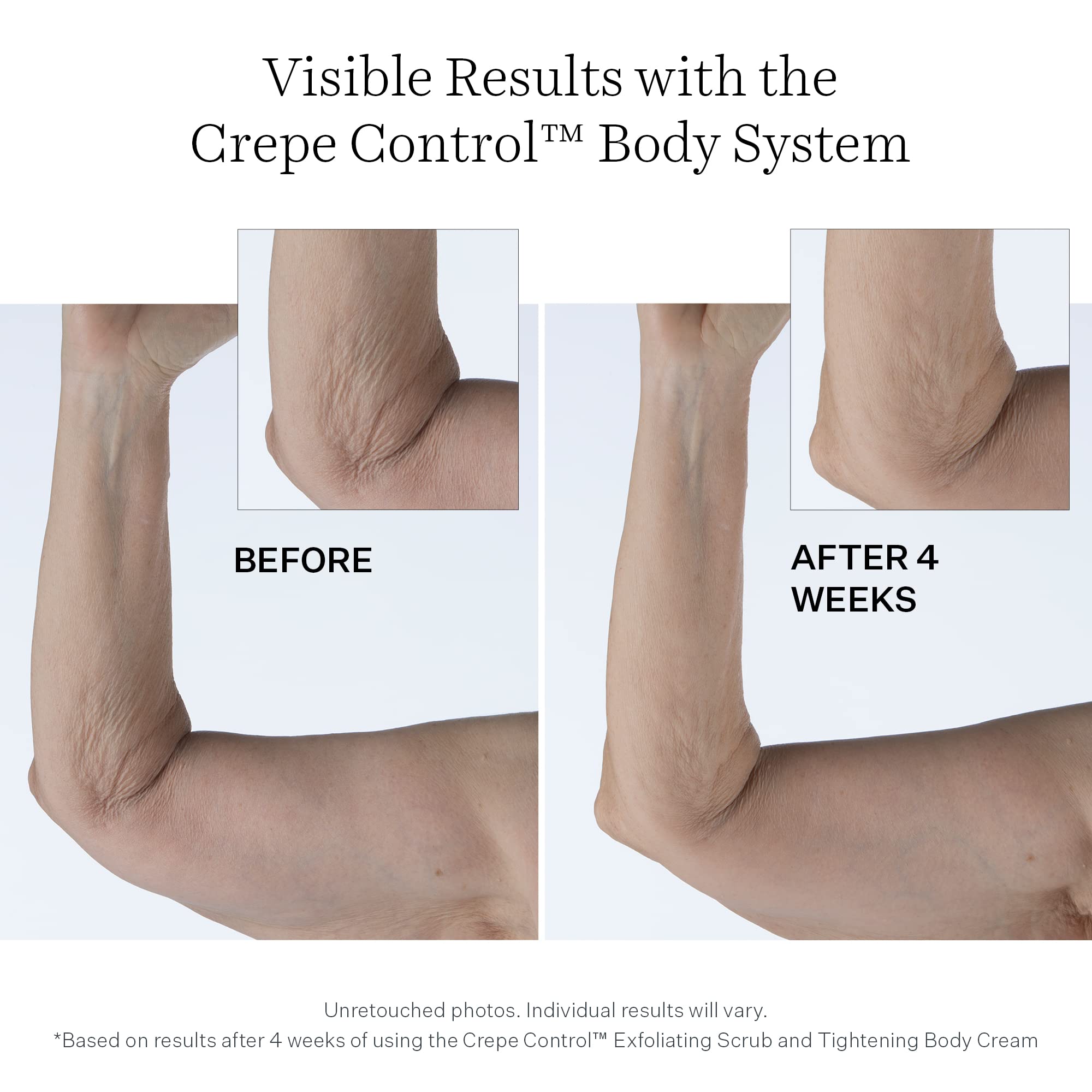 StriVectin Tighten & Lift Crepe Control Body Creams & Treatments, Improving Crepey & Saggy Skin, Hydrating Moisture for your Skin