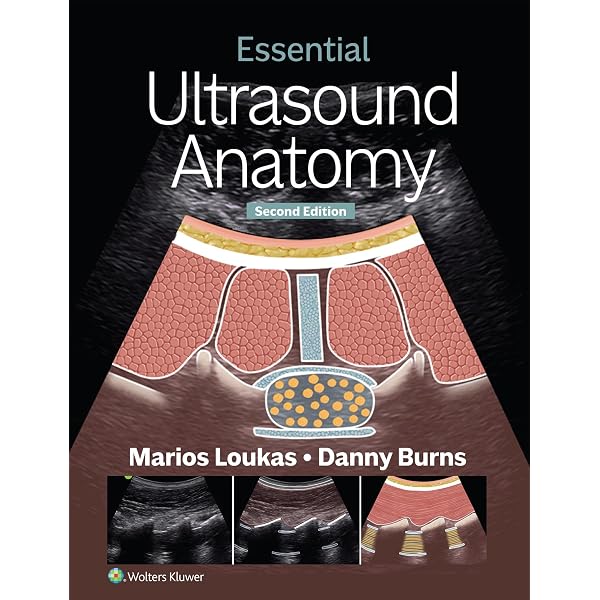 Amazon.com: Ultrasound for Primary Care eBook : Bornemann, Paul