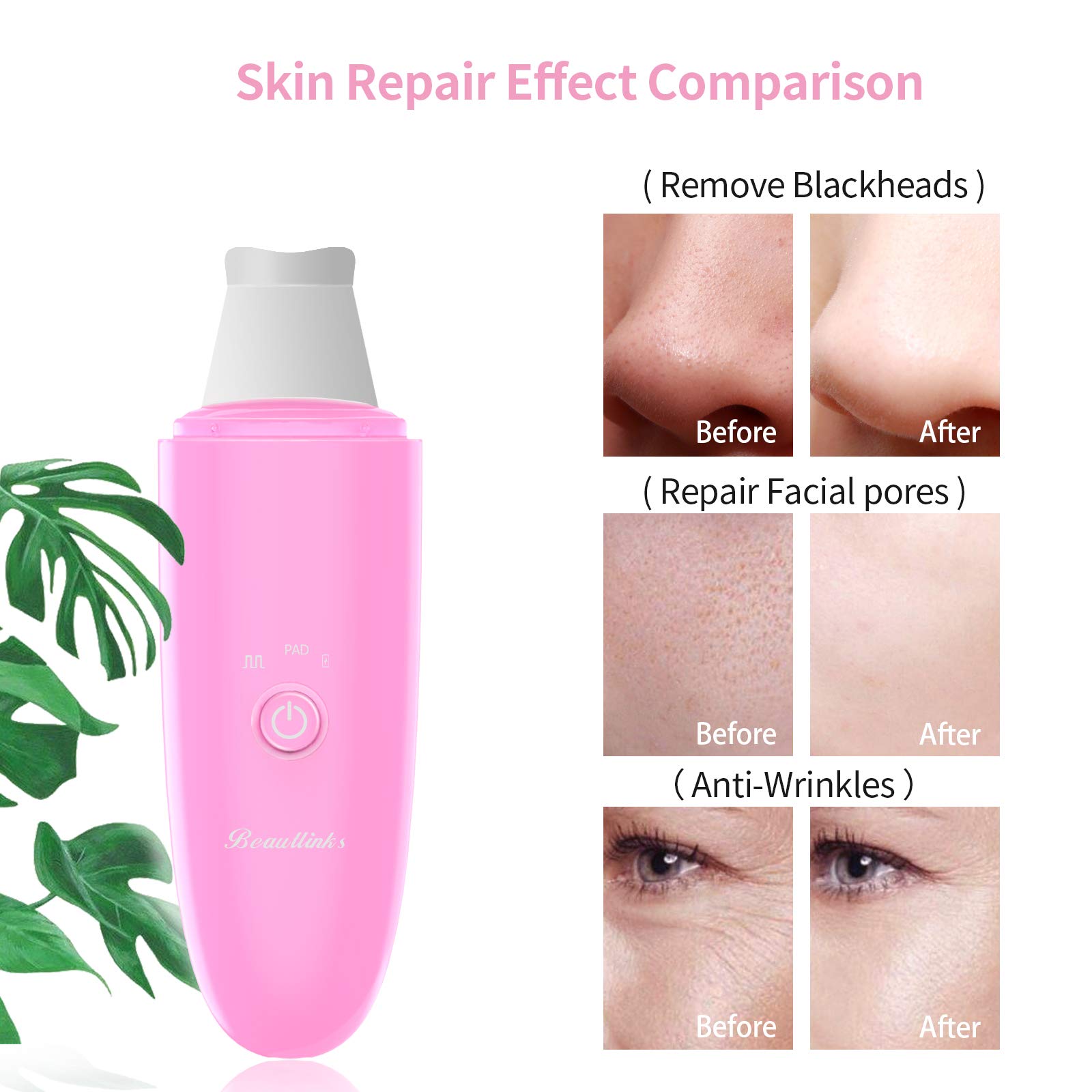 Facial Skin Scrubber Blackhead Remover, Beautlinks Facial Skin Spatula Pore Cleanser Facial Lifting Skin Massage Tool, USB Rechargeable Blackhead Comedone Extractor for Pore Deep Clean