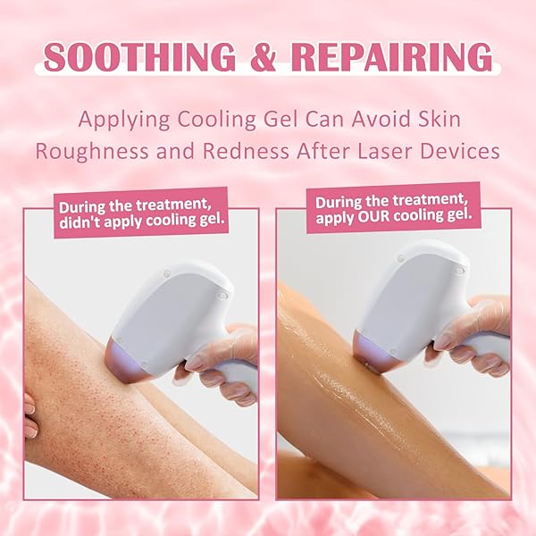 DUOVIO COUPLING AND COOLING GEL USE WITH IPL HAIR REMOVAL DEVICE AND BEAUTY FACIAL MACHINE FOR WOMEN OR MEN IN FACE AND BODY 300ML