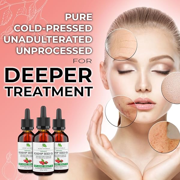 ROSEHIP OIL – PURE, VIRGIN, COLD PRESSED – FROM WHOLE BERRIES (PULP & SEEDS), NATURAL DEEP ORANGE HUE FOR INTENSIVE SKIN REPAIR – UNDILUTED ORGANIC ROSEHIP SEED OIL, 2 OZ