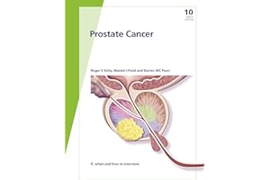 Fast Facts: Prostate Cancer: If, when and how to intervene