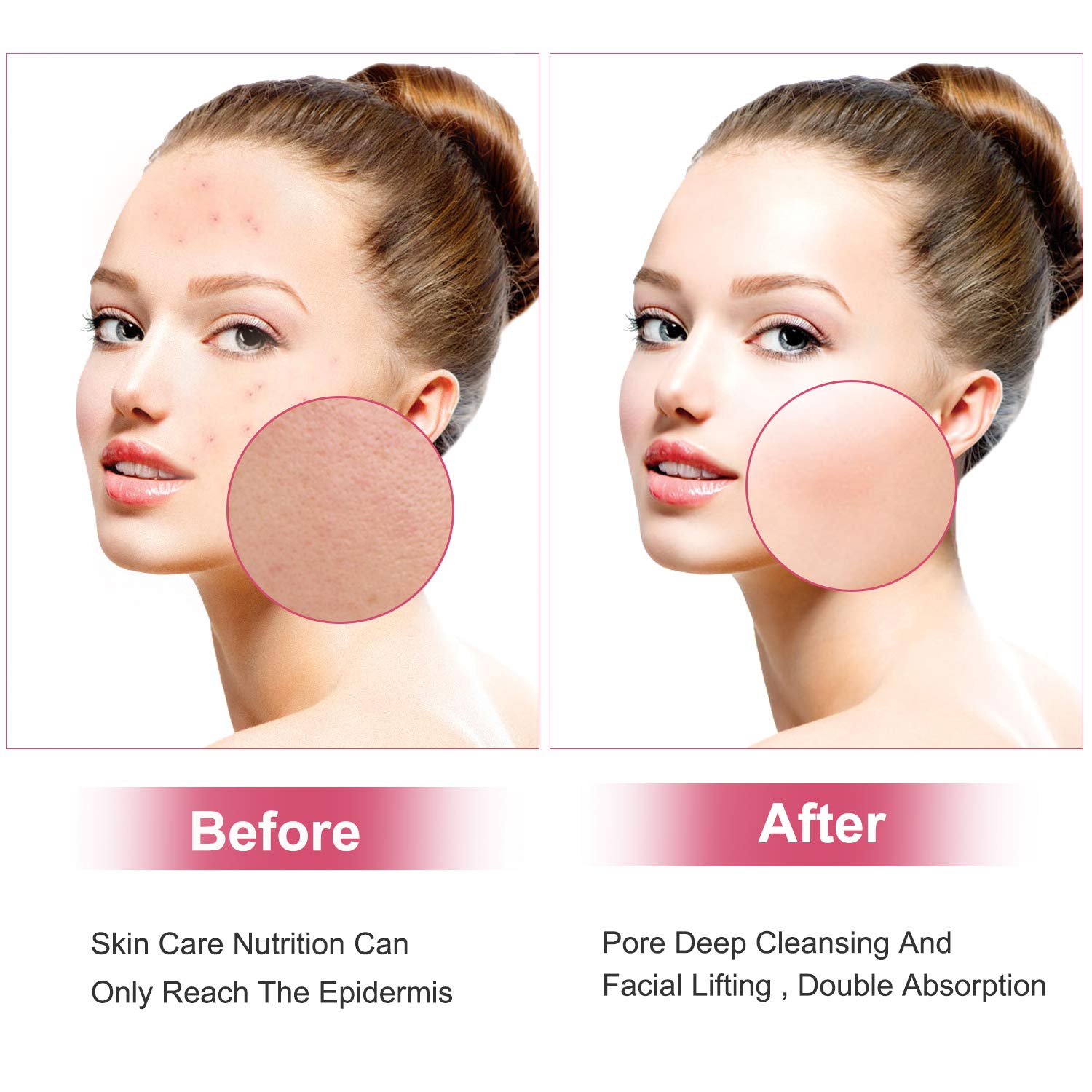 Facial Skin Scrubber, Face Spatula Portable Pores Cleanser Blackhead Remover Comedone Extractor Skin Exfoliator and Facial Lifting Tool, Portable Rechargeable.