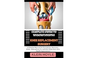 COMPLETE GUIDE TO UNDERSTANDING KNEE REPLACEMENT SURGERY: A Detailed Manual On Procedures, Recovery, Risks, Alternatives For 