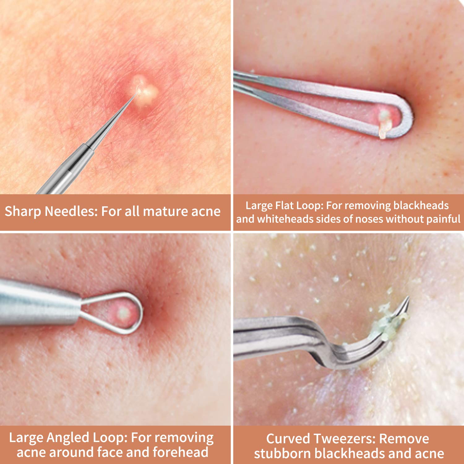 Anjou Blackhead Remover Comedone Extractor, Curved Blackhead Tweezers Kit, 11-Heads Professional Stainless Pimple Acne Blemish Removal Tools Set, Silver: Beauty