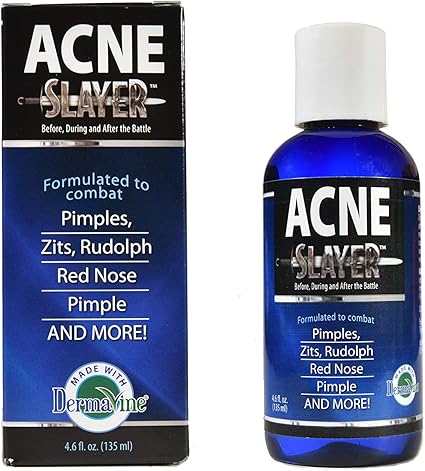 blackheads rosacea