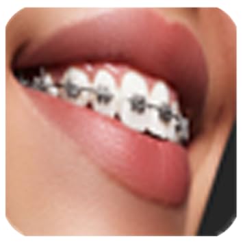 braces bretelles
