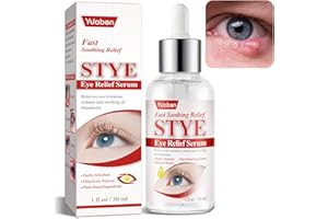 Yuaben Stye Eye Treatment Drops, 30ml，Eye Stye Remover for Chalazion, Blepharitis & Stye Removal