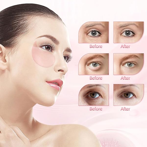 OZFU UNDER EYE PATCHES (30 PAIRS), EYE MASK FOR PUFFY EYES, DARK CIRCLES,BAGS AND WRINKLES WITH COLLAGEN,RELIEVES PRESSURE AND REDUCES WRINKLES
