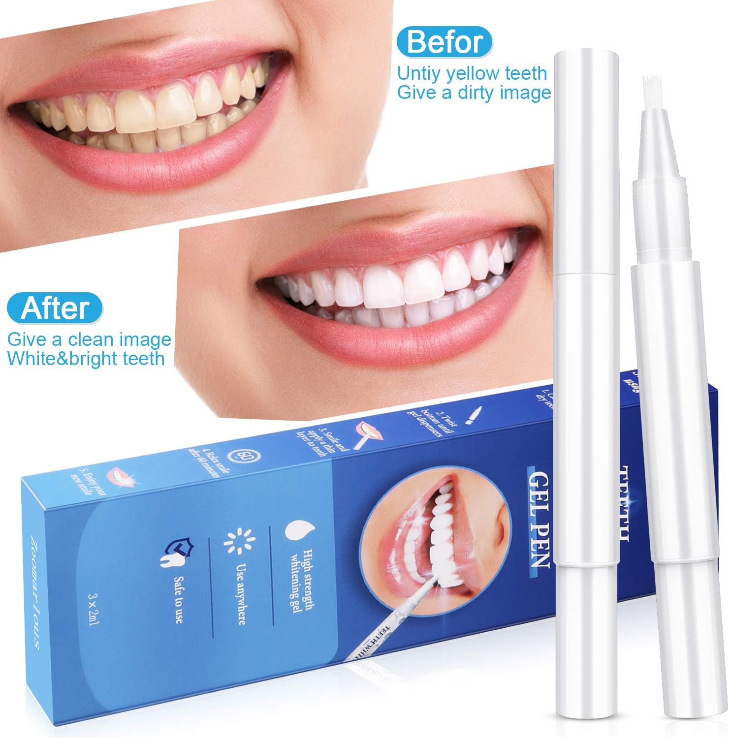Zoomarlous Teeth Whitening Pen 3 Pack - 30+ Uses Whitening Treatments, 35% Carbamide Peroxide, No Sensitivity, Remove Coffee and Tea Stains Professional Dental Whitener, Beautiful White Smile, 3x2 ml: Health & Personal Care