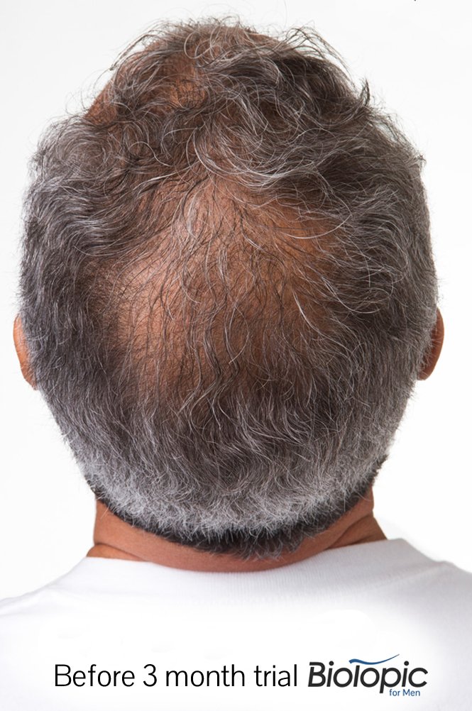 Premium Hair Growth Conditioner with Keratin, 8 Ounces: Beauty