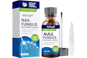 LINDESA Toenail Fungus Treatment Extra Strength,Toenail Fungus Treatment For Toenail Or Fingernail,Nail Fungus Treatment for Athletes Foot, Thick, Broken, Discolored & Damaged Nail - Safely and Gently-30Ml