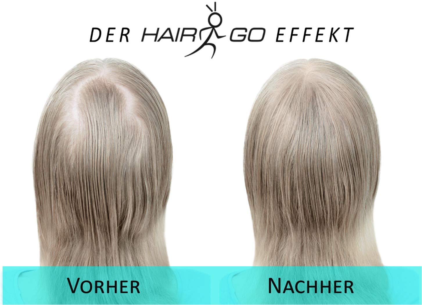HAIR GO Premium Schütthaar zur Haarverdichtung | Haarpuder | Streuhaar | Haarauffüller | Haarausfall | Haarverdichter 100% natürlich & vegan, 1er Pack, (1x 25 gr.) (schwarz) 5