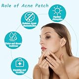 Azonelife 144 Hydrocolloid Acne Patches Face Spots Pimple Treatment Stickers view 5