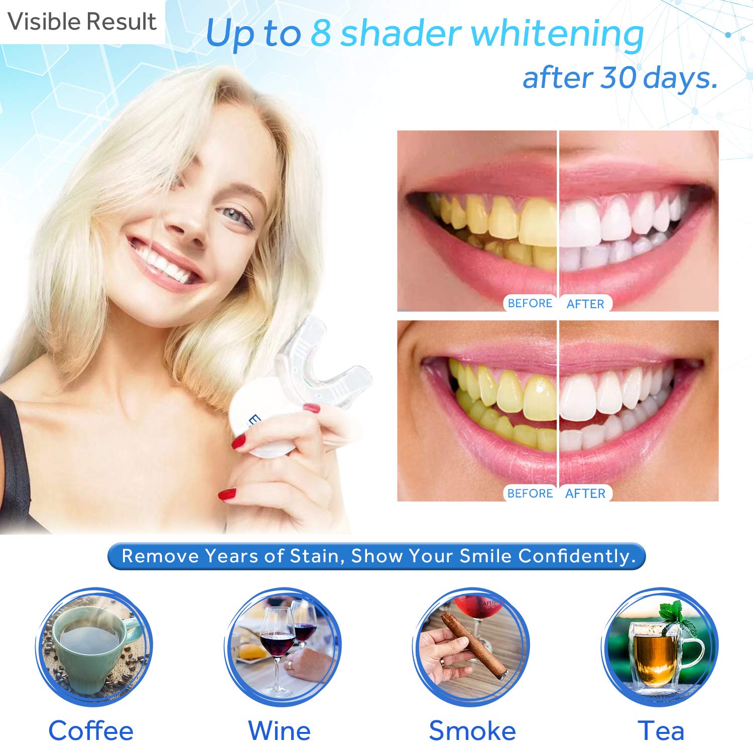 Teeth Whitening Kit with LED Light, 10min Fast-Result Teeth Whitening, Non-Sensitive Teeth Whitener and Teeth Whitening Gel Pen, Carbamide Peroxide Tooth Whitening Remove Stains from Coffee and Soda: Beauty